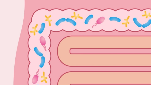 Stanford scientists link ulcerative colitis to missing gut microbes 